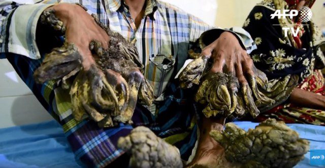 Lhomme-arbre-640x331 États-Unis : La Cour suprême pourrait annuler la condamnation de Steve Bannon, ancien conseiller de Trump