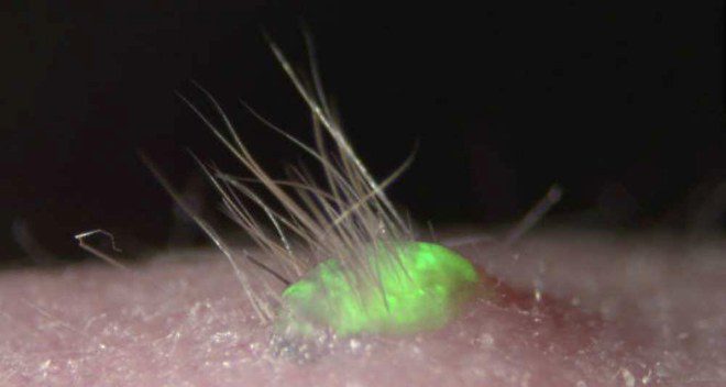 Japon : une peau artificielle, aux spécificités effleurant la nôtre, développée sur des souris !