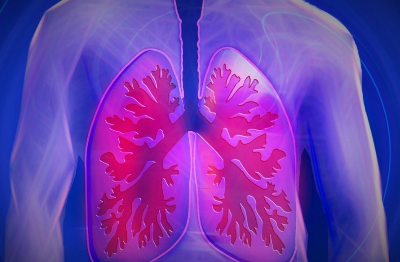 MoovCare : une application qui simplifie le suivi en partie auto-géré des malades d’un cancer du poumon