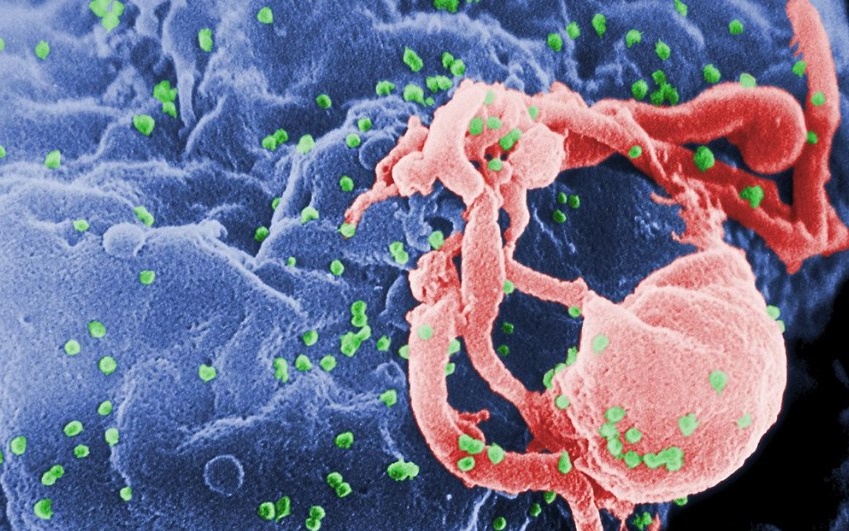 À Paris, une personne infectée par le VIH sur cinq vit sans savoir qu’elle est atteinte de la maladie