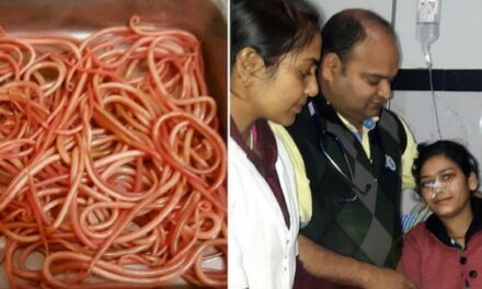 Inde : opération chirurgicale réussie pour retirer 150 vers des intestins d’une jeune patiente de 22 ans