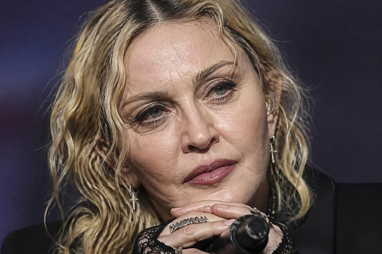 découvrez les séquelles physiques que madonna a subies après plusieurs décennies sur scène, révélant les défis d'une carrière artistique intense.